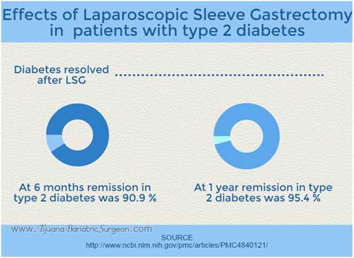 Type-2 Diabetes and Sleeve Gastrectomy